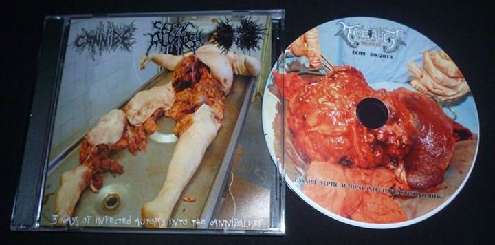 CANNIBE - 3 Ways of Infected Autopsy into the Cannibalism cover 