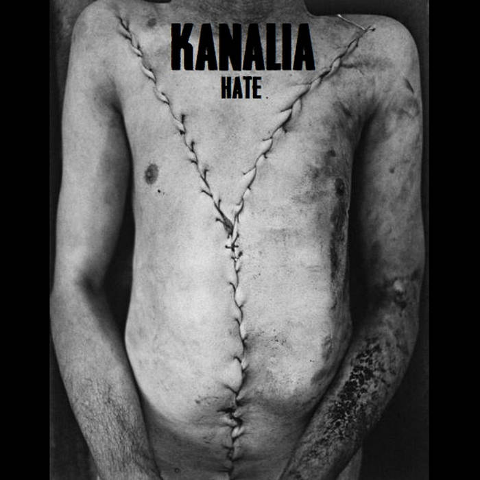 KANALIA - Hate cover 