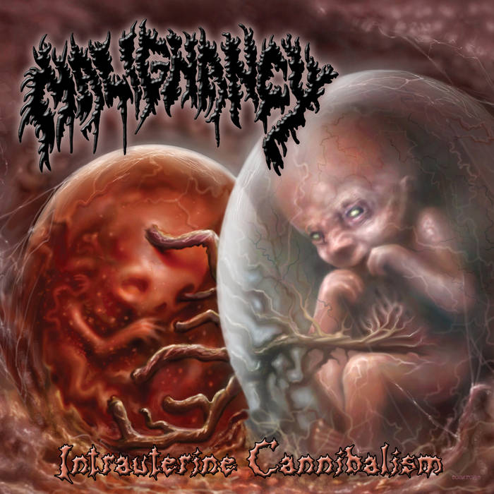 MALIGNANCY - Intrauterine Cannibalism (2019) cover 