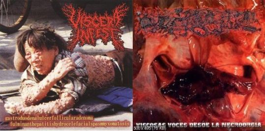 PARACOCCIDIOIDOMICOSISPROCTITISSARCOMUCOSIS - Viscera Infest / Paracoccidioidomicosisproctitissarcomucosis cover 