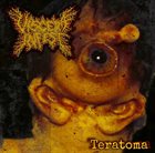 VISCERA INFEST — Teratoma album cover